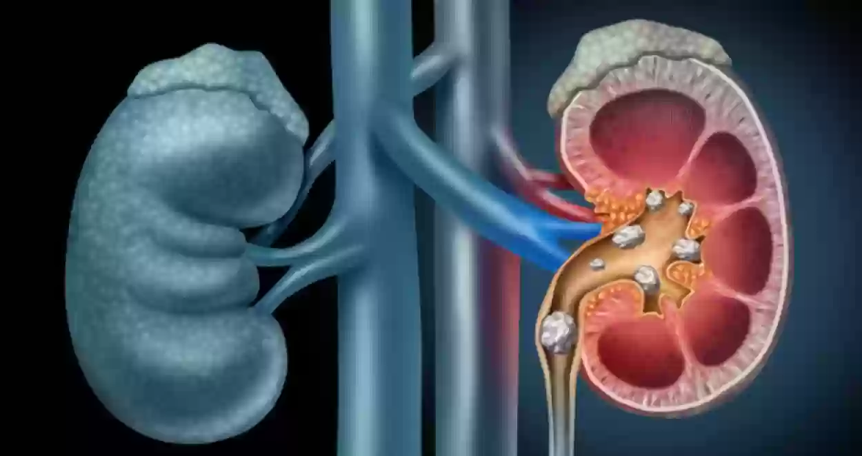 احذر الفشل الكلوي | كيف أعرف أن الكلى تعبانه؟! علامات تدل على ان كليتك في خطر